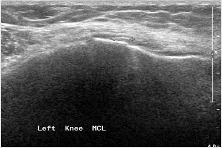 biomedres-openaccess-journal-bjstr