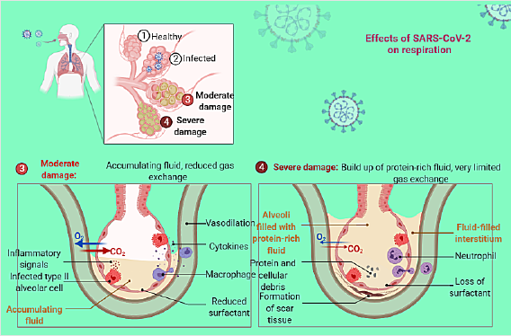 biomedres-openaccess-journal-bjstr