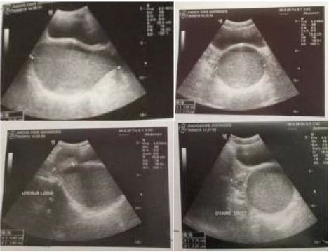 biomedres-openaccess-journal-bjstr
