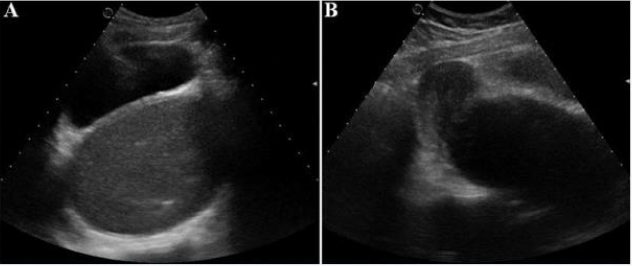 biomedres-openaccess-journal-bjstr