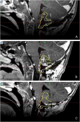 biomedres-openaccess-journal-bjstr