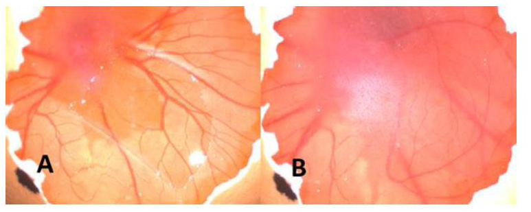 biomedres-openaccess-journal-bjstr