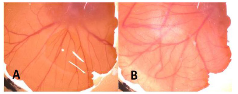 biomedres-openaccess-journal-bjstr