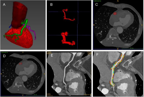 biomedres-openaccess-journal-bjstr