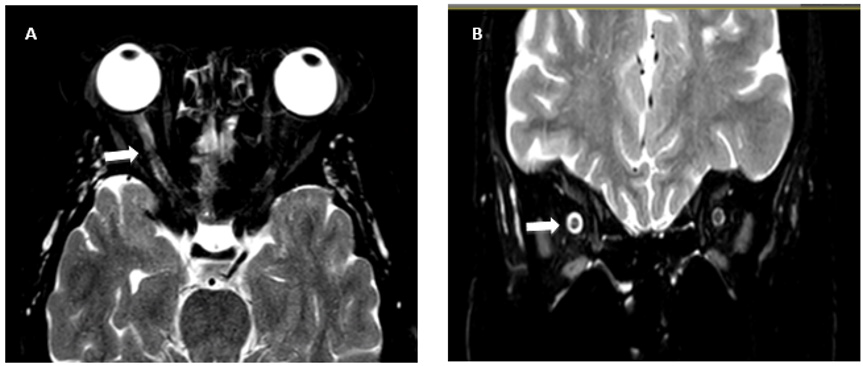 biomedres-openaccess-journal-bjstr