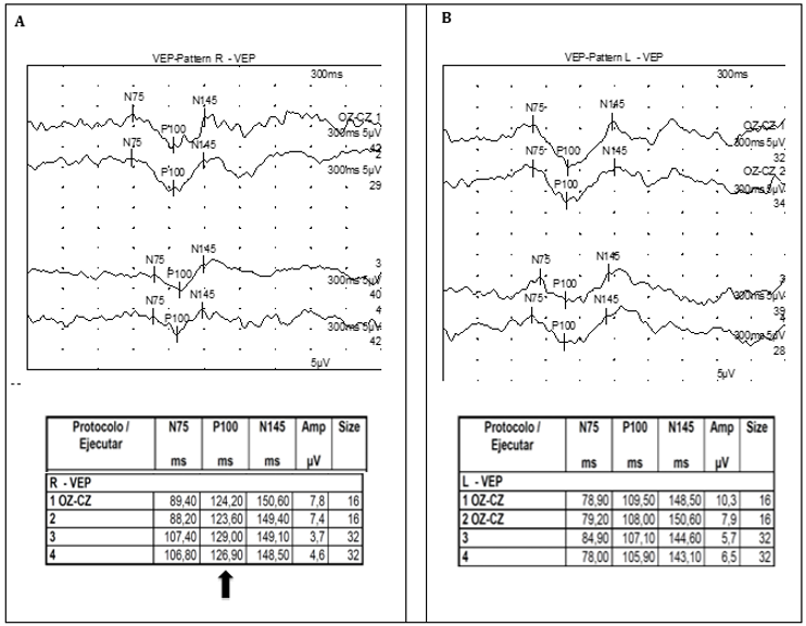 biomedres-openaccess-journal-bjstr