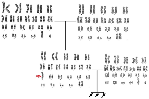 biomedres-openaccess-journal-bjstr