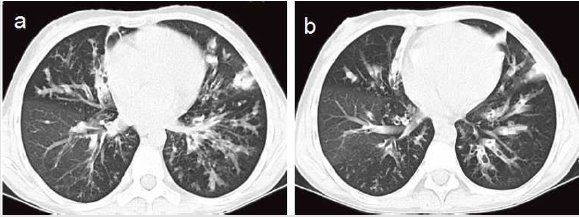 biomedres-openaccess-journal-bjstr