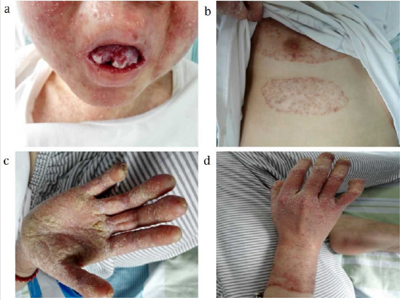 biomedres-openaccess-journal-bjstr