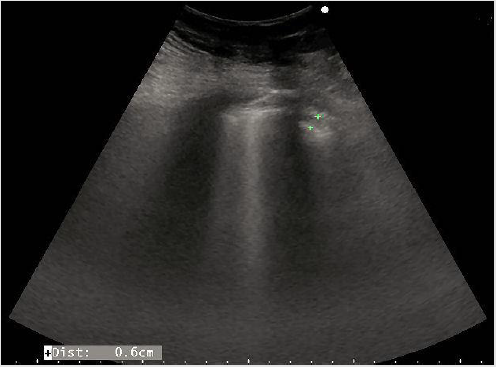 biomedres-openaccess-journal-bjstr
