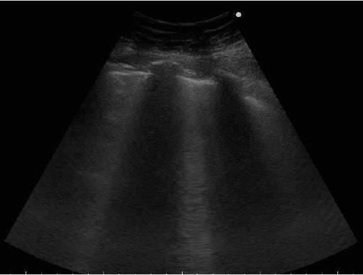 biomedres-openaccess-journal-bjstr