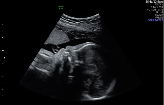 biomedres-openaccess-journal-bjstr