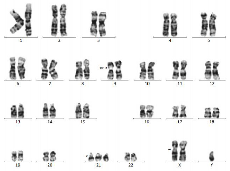 biomedres-openaccess-journal-bjstr