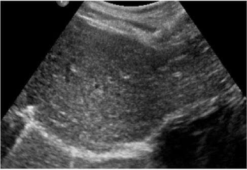 biomedres-openaccess-journal-bjstr