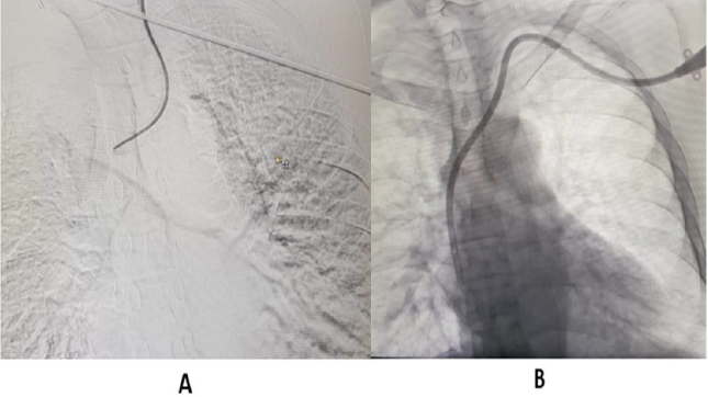 biomedres-openaccess-journal-bjstr