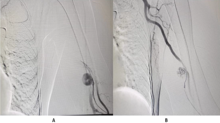 biomedres-openaccess-journal-bjstr