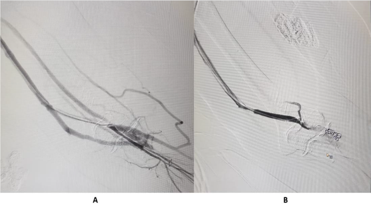 biomedres-openaccess-journal-bjstr