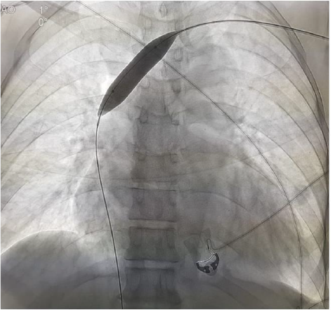 biomedres-openaccess-journal-bjstr