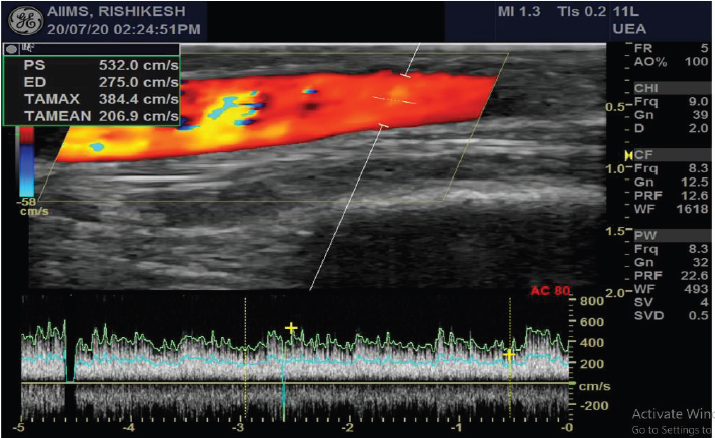 biomedres-openaccess-journal-bjstr
