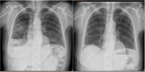 biomedres-openaccess-journal-bjstr
