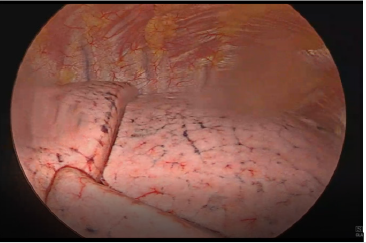 biomedres-openaccess-journal-bjstr