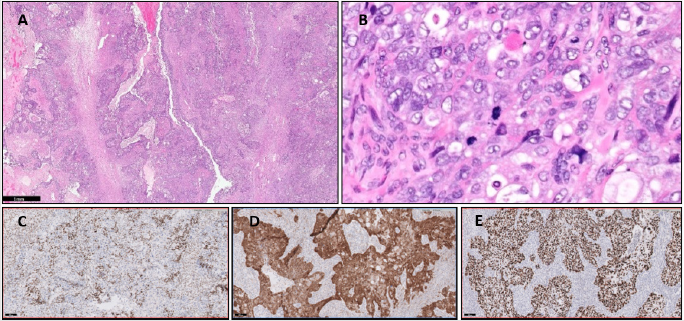 biomedres-openaccess-journal-bjstr