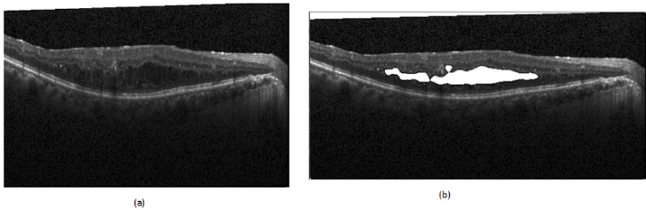 biomedres-openaccess-journal-bjstr