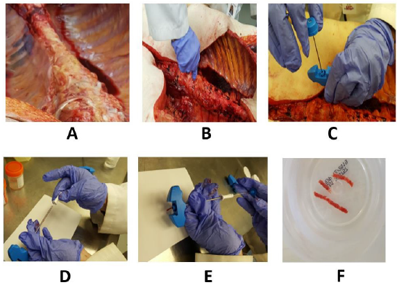 biomedres-openaccess-journal-bjstr