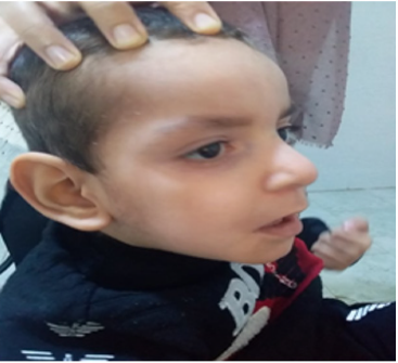 biomedres-openaccess-journal-bjstr