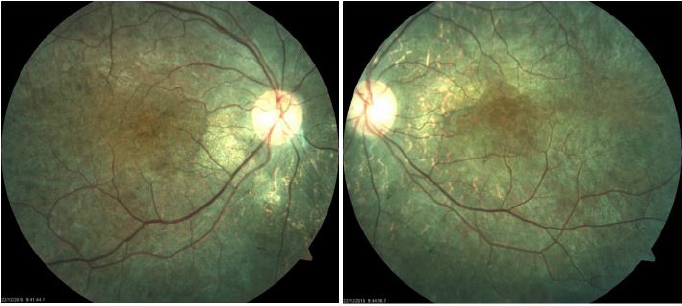 biomedres-openaccess-journal-bjstr
