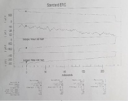 biomedres-openaccess-journal-bjstr