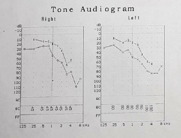 biomedres-openaccess-journal-bjstr