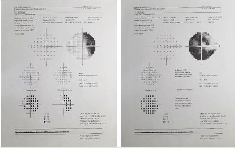 biomedres-openaccess-journal-bjstr
