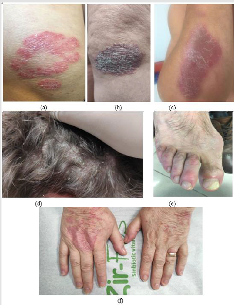 biomedres-openaccess-journal-bjstr