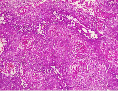 biomedres-openaccess-journal-bjstr