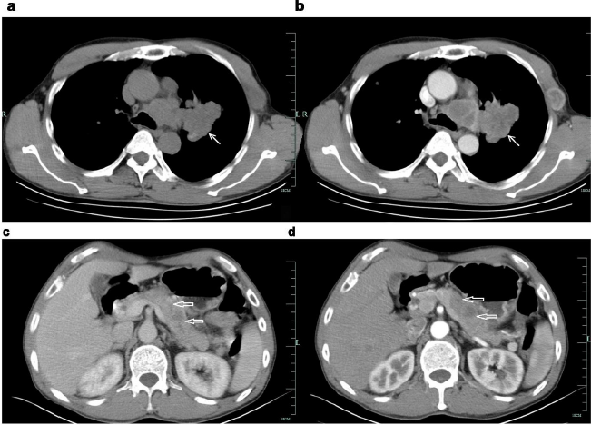biomedres-openaccess-journal-bjstr