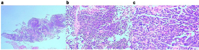 biomedres-openaccess-journal-bjstr