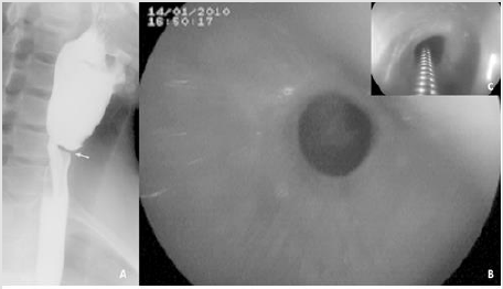 biomedres-openaccess-journal-bjstr