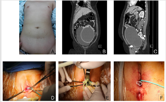 biomedres-openaccess-journal-bjstr