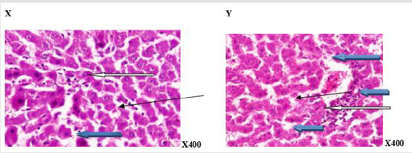 biomedres-openaccess-journal-bjstr