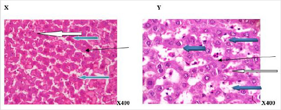 biomedres-openaccess-journal-bjstr