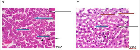 biomedres-openaccess-journal-bjstr