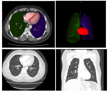 biomedres-openaccess-journal-bjstr