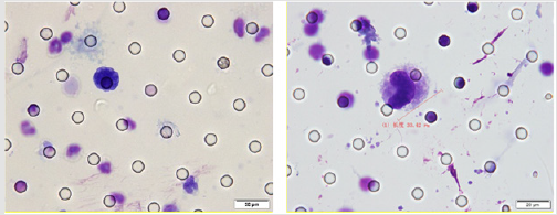 biomedres-openaccess-journal-bjstr