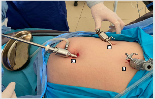 biomedres-openaccess-journal-bjstr