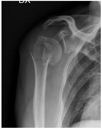 biomedres-openaccess-journal-bjstr