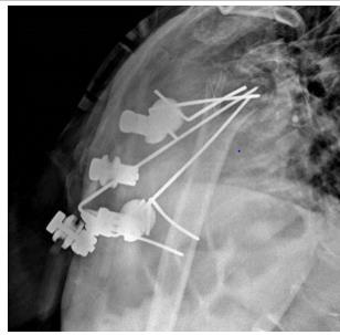 biomedres-openaccess-journal-bjstr