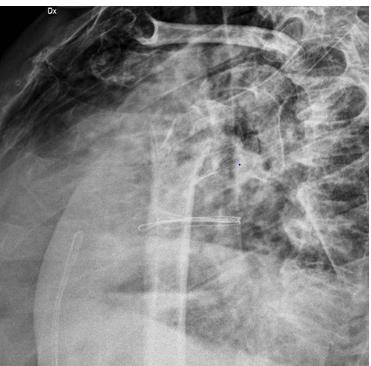 biomedres-openaccess-journal-bjstr