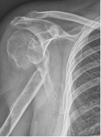 biomedres-openaccess-journal-bjstr