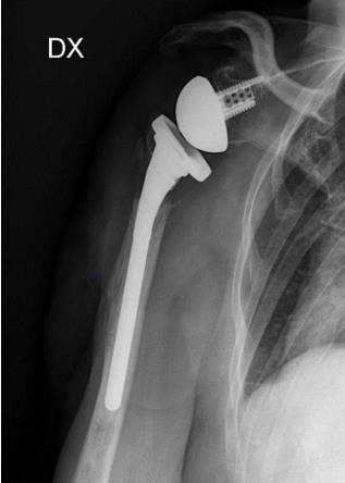 biomedres-openaccess-journal-bjstr